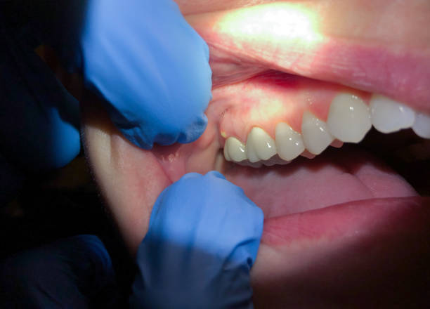 Best Tooth Infection Emergency Dentist  in Norwalk, CA